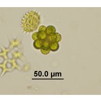 Coelastrum microporum
