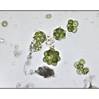 Coelastrum microporum