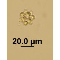 Coelastrum pseudomicroporum