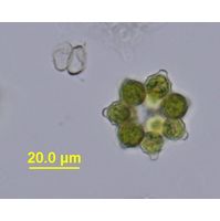 Coelastrum pulchrum