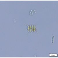 Desmodesmus flavescens