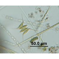 Desmodesmus opoliensis