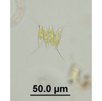 Desmodesmus opoliensis