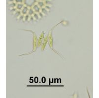 Desmodesmus opoliensis