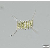 Desmodesmus protuberans