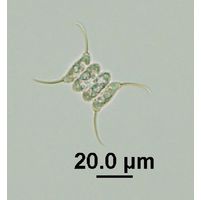Desmodesmus communis