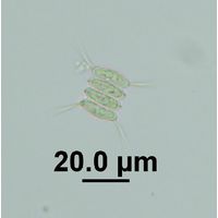 Desmodesmus armatus