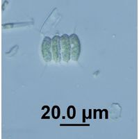 Desmodesmus cf. longispina