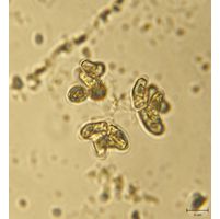 Dimorphococcopsis