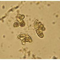 Dimorphococcopsis