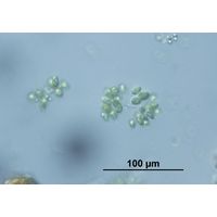 Dimorphococcus lunatus