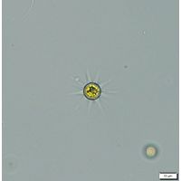 Echinosphaerella limnetica