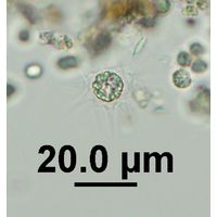 Echinosphaerella limnetica