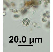 Echinosphaerella limnetica