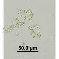 Kirchneriella contorta