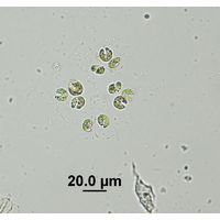 Kirchneriella obesa