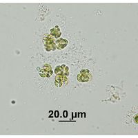 Kirchneriella obesa