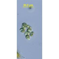 Kirchneriella