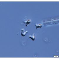 Kirchneriella irregularis