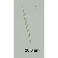 Monoraphidium griffithii