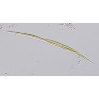 Monoraphidium griffithii