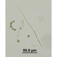 Monoraphidium komarkovae