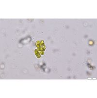 Nephrocytium