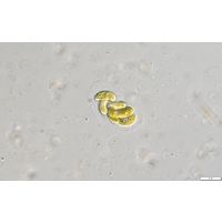 Nephrocytium