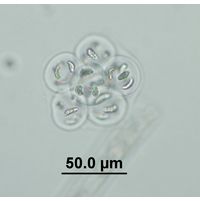 Nephrocytium limneticum