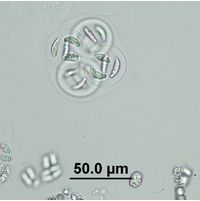 Nephrocytium limneticum