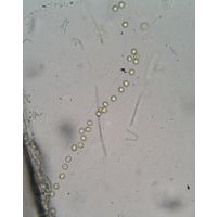 Palmodictyon viride