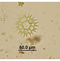 Lacunastrum gracillimum