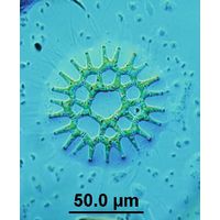 Lacunastrum gracillimum