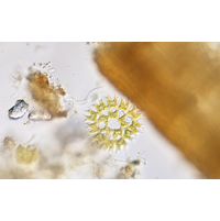 Parapediastrum biradiatum