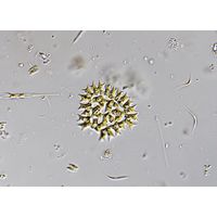 Parapediastrum biradiatum