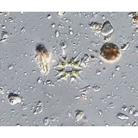 Parapediastrum biradiatum var. longicorne