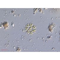 Parapediastrum biradiatum var. longicorne