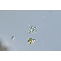 Parapediastrum biradiatum var. longicorne