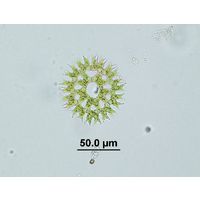 Parapediastrum biradiatum