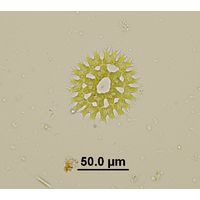 Parapediastrum biradiatum