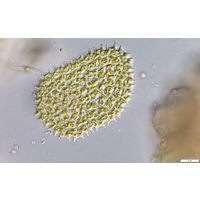 Pediastrum angulosum