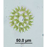 Parapediastrum biradiatum