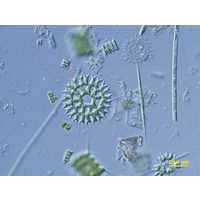 Parapediastrum biradiatum