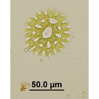 Parapediastrum biradiatum