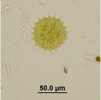 Pseudopediastrum boryanum