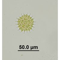 Pseudopediastrum boryanum