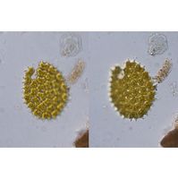 Pediastrum cfr. sculptatum