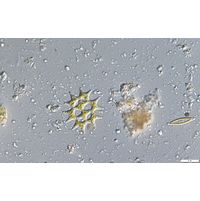 Pediastrum duplex