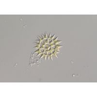 Pediastrum duplex