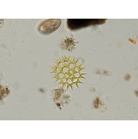 Pediastrum duplex